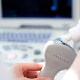 انواع پروب‌های سونوگرافی